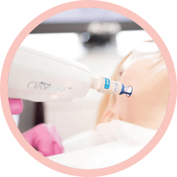 Laser clear lift Laser clear lift